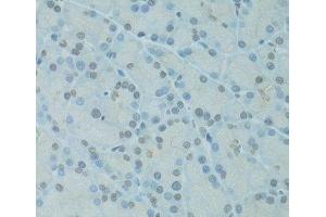 Immunohistochemistry of paraffin-embedded Rat pancreas using GTF2H2C Polyclonal Antibody at dilution of 1:100 (40x lens). (GTF2H2C anticorps)