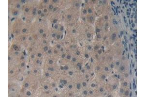 Detection of HMGCS in Human Liver Tissue using Polyclonal Antibody to Hydroxymethylglutaryl Coenzyme A Synthase (HMGCS)