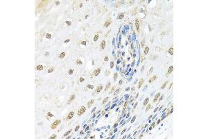 Immunohistochemistry of paraffin-embedded human esophagus using ELAC2 antibody at dilution of 1:100 (x40 lens). (ELAC2 anticorps)
