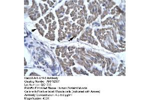 Human Skeletal Muscle (EYA3 anticorps  (Middle Region))