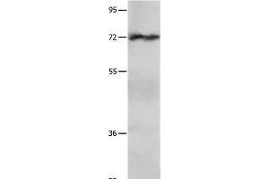 Western Blot analysis of Hela cell using IGF2BP1 Polyclonal Antibody at dilution of 1:750 (IGF2BP1 anticorps)