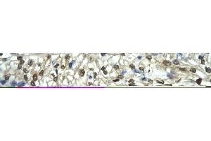 Rabbit Anti-FLI1 Antibody       Paraffin Embedded Tissue:  Human cardiac cell   Cellular Data:  Epithelial cells of renal tubule  Antibody Concentration:   4.