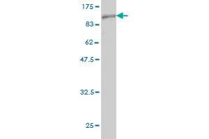 Western Blot detection against Immunogen (89. (CDKN2AIP anticorps  (AA 1-579))