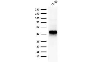 Western Blot Analysis of human lung lysate using EpCAM Mouse Monoclonal Antibody (EGP40/1373). (EpCAM anticorps  (Extracellular Domain))