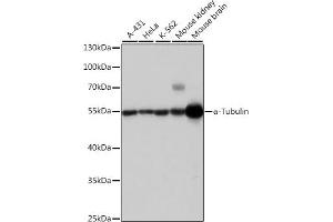 Western blot analysis of extracts of various cell lines, using α-Tubulin antibody (ABIN3020549, ABIN3020550 and ABIN3020551) at 1:1000 dilution. (TUBA4A anticorps  (AA 1-180))
