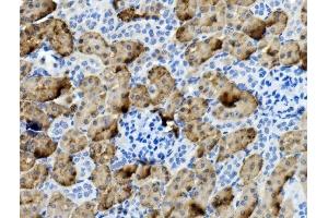 IHC analysis of PCK1/PEPC using anti-PCK1/PEPC antibody (ABIN7599502). (PCK1 anticorps  (AA 1-622))