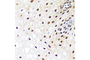 Immunohistochemistry of paraffin-embedded human esophageal using UB Rabbit mAb (ABIN7271185) at dilution of 1:100 (40x lens). (UBA1 anticorps)
