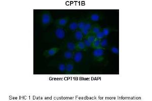 rsearcher: Dr. (CPT1B anticorps  (Middle Region))