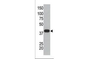 The anti-SUMO1 polyclonal antibody (ABIN388027 and ABIN2845493) is used in Western blot to detect GST-SUMO1 fusion protein. (SUMO1 anticorps  (C-Term))