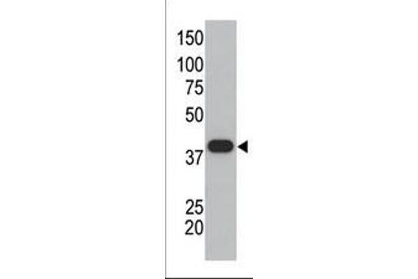 SUMO1 anticorps  (C-Term)