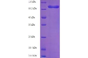 Electron-Transferring-Flavoprotein Dehydrogenase (ETFDH) (AA 34-617) protein (His-SUMO Tag)