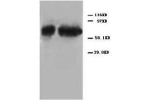 Western blot analysis of Hela cell lysis using P73alpha antibody (Tumor Protein p73 anticorps  (C-Term))