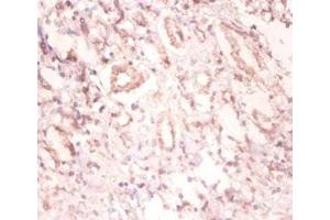 Immunohistochemistry of paraffin-embedded human kidney tissue using ABIN7174131 at dilution of 1:100 (SNRPA1 anticorps  (AA 8-278))