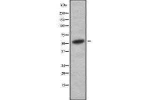 Western blot analysis of V-ATPase H using HuvEc whole cell lysates (ATP6V1H anticorps  (Internal Region))