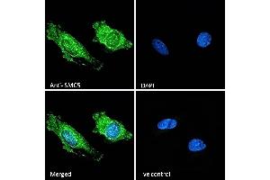 (ABIN570758) Immunofluorescence analysis of paraformaldehyde fixed HeLa cells, permeabilized with 0. (SMC5 anticorps  (Internal Region))