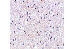 Immunohistochemistry of MORF4 in human brain tissue with MORF4 antibody at 5 μg/ml. (MORF4 anticorps  (N-Term))