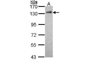 WB Image Sample (30 ug of whole cell lysate) A: Hep G2 , 7. (DDB1 anticorps  (C-Term))