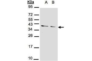 WB Image Sample(30 μg of whole cell lysate) A:293T B:A431, 12% SDS PAGE antibody diluted at 1:1000