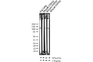 Western blot analysis of Phospho-p130 Cas (Tyr410) expression in various lysates