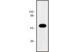 Western blot of human Jurkat T cell line (alpha Tubulin anticorps)