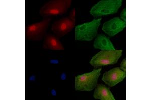 ABIN6259295 and ABIN6273500 staining  cells by IF/ICC.