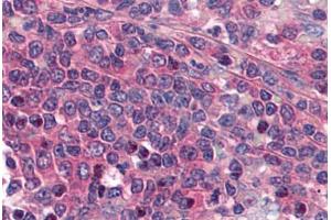 Human Spleen (formalin-fixed, paraffin-embedded) stained with PTGER1 antibody ABIN297511 at 2. (PTGER1 anticorps  (AA 248-260))