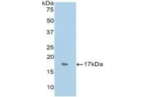 Detection of Recombinant RNASE7, Human using Polyclonal Antibody to Ribonuclease A7 (RNASE7) (RNASE7 anticorps  (AA 31-155))