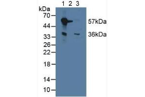 Western blot analysis of (1) Mouse Liver Tissue, (2) Mouse Brain Tissue and (3) Mouse Kidney Tissue. (Monoamine Oxidase B anticorps  (AA 206-505))