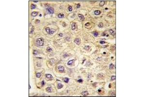 Immunohistochemistry (IHC) image for anti-TYRO3 Protein Tyrosine Kinase (TYRO3) antibody (ABIN356409)