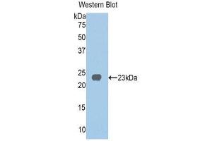 Western Blotting (WB) image for anti-Homogentisate 1,2-Dioxygenase (HGD) (AA 239-428) antibody (ABIN1859143) (HGD anticorps  (AA 239-428))