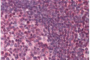 Human Small Intestine, Peyer's Patch (formalin-fixed, paraffin-embedded) stained with DAPK3 antibody ABIN214482 at 2. (DAPK3 anticorps  (Internal Region))