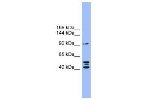 ENPP2 antibody used at 1 ug/ml to detect target protein. (ENPP2 anticorps  (N-Term))