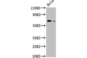 Western Blot Positive WB detected in: Hela whole cell lysate All lanes: TRIP4 antibody at 4 μg/mL Secondary Goat polyclonal to rabbit IgG at 1/50000 dilution Predicted band size: 67 kDa Observed band size: 67 kDa (TRIP4 anticorps  (AA 360-535))