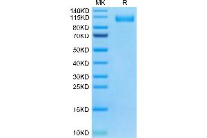 SDS-PAGE (SDS) image for SARS-CoV-2 Spike S1 (BA.4 - Omicron), (BA.5 - Omicron) protein (His tag) (ABIN7273920)