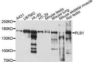 Western blot analysis of extracts of various cell lines, using PLB1 antibody (ABIN5998536) at 1/1000 dilution. (Phospholipase B anticorps)