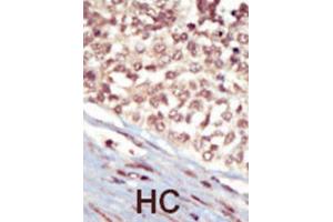 Immunohistochemistry (IHC) image for anti-EPH Receptor A5 (EPHA5) antibody (ABIN3003333) (EPH Receptor A5 anticorps)