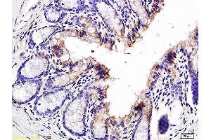 Formalin-fixed and paraffin embedded mouse colon labeled with Anti-Jagged1/CD339 Polyclonal Antibody, Unconjugated (ABIN686677) at 1:200 followed by conjugation to the secondary antibody and DAB staining. (JAG1 anticorps)