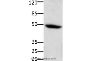 Western blot analysis of Mouse heart tissue, using CSF2RA Polyclonal Antibody at dilution of 1:400 (CSF2RA anticorps)
