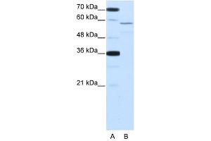 NOVA2 antibody used at 2. (NOVA2 anticorps  (Middle Region))