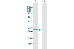 Western Blot analysis of PGDS expression in transfected 293T cell line by PGDS MaxPab polyclonal antibody.