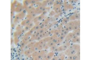 IHC-P analysis of Human Tissue, with DAB staining. (Glypican 3 anticorps  (AA 343-559))