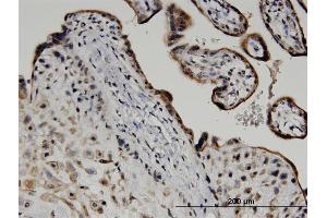 Immunoperoxidase of monoclonal antibody to ATF6 on formalin-fixed paraffin-embedded human placenta.