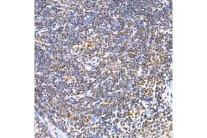 Immunohistochemistry of paraffin-embedded mouse liver using PPARγ Rabbit pAb (ABIN3020843, ABIN3020844, ABIN3020845, ABIN1513399 and ABIN6213752) at dilution of 1:200 (40x lens).