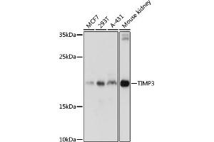 Western blot analysis of extracts of various cell lines, using TIMP3 antibody (ABIN6134857, ABIN6149180, ABIN6149181 and ABIN6215546) at 1:1000 dilution. (TIMP3 anticorps  (C-Term))