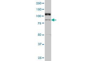 ALS2CR8 monoclonal antibody (M01), clone 2A3 Western Blot analysis of ALS2CR8 expression in Hela S3 NE . (Calcium Responsive Transcription Factor (CARF) (AA 621-718) anticorps)