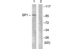 Western blot analysis of extracts from LOVO cells, using SP1 (Ab-453) Antibody. (SP1 anticorps  (AA 421-470))