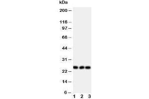 Western blot testing of FGF19 antibody and Lane 1:  rat brain;  2: U87;  3: SMMC-7721 cell lysate (FGF19 anticorps  (Middle Region))