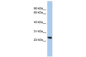 PSMB2 antibody used at 1 ug/ml to detect target protein.
