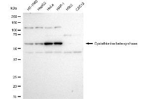 Western blotting analysis using Cystathionine beta-synthase antibody (ABIN7798235).