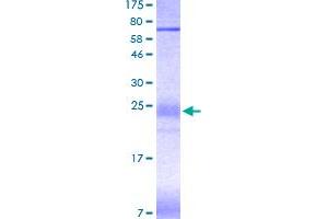 SDS-PAGE (SDS) image for Cytotoxic T-Lymphocyte-Associated Protein 4 (CTLA4) (AA 37-161) protein (His-DYKDDDDK-Strep II Tag) (ABIN4369863)